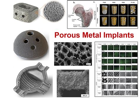  Titanium: Het Metaal voor de Toekomst van Implanten en Aeroruimtetoepassingen?